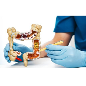 Các vấn đề nguy hiểm về đường ruột